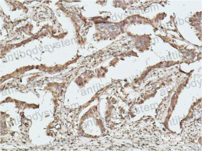 Валидация AntibodySystem RHE03703