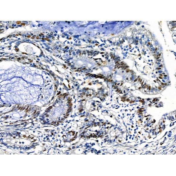 Валидация Affinity DF6201 - 17461