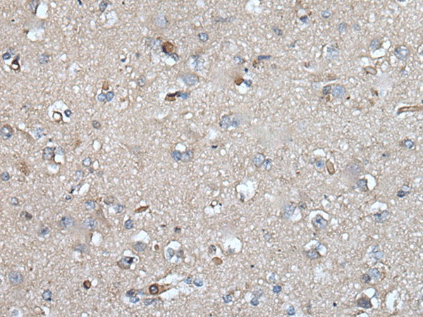 Валидация Elabscience E-AB-52440