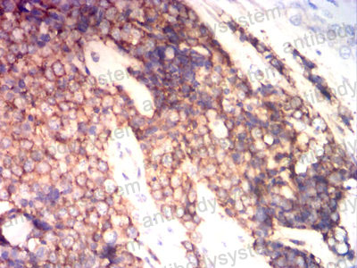 Валидация AntibodySystem RHD03605