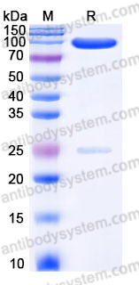 EHJ48201, SDS-PAGE