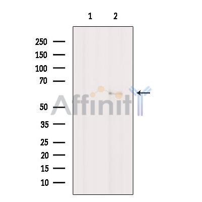 Валидация Affinity DF10146 - 5670
