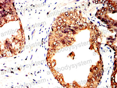 Валидация AntibodySystem RHN88904