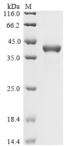 SDS-PAGE