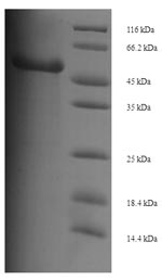 SDS-PAGE