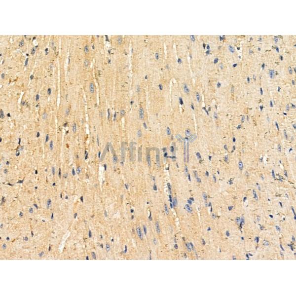 Валидация Affinity DF3684 - 14699