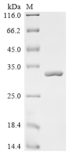 SDS-PAGE