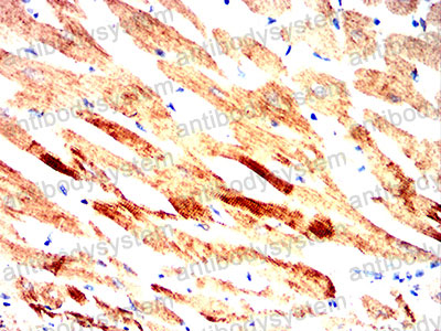 Валидация AntibodySystem RHG56101