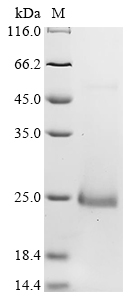 SDS-PAGE