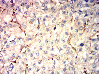 Валидация AntibodySystem RHE77502 (2316)