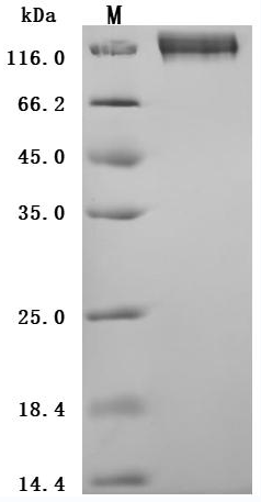 SDS-PAGE