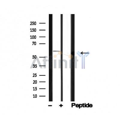 Валидация Affinity AF4718 - 2335