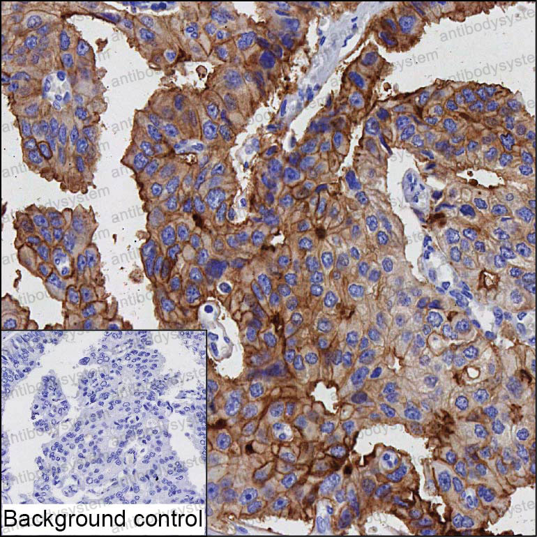 Валидация AntibodySystem RHK39701