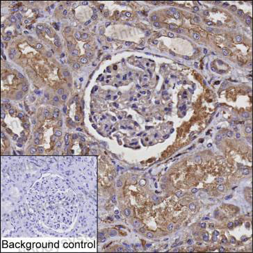 Валидация AntibodySystem RHE69703
