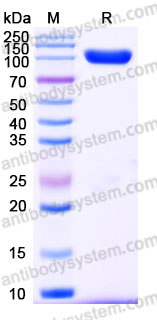 EHD56301, SDS-PAGE