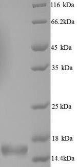 SDS-PAGE