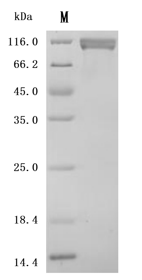 SDS-PAGE