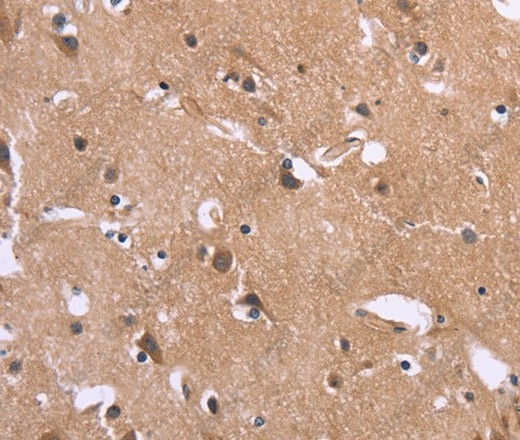 Иммуногистохимия, GPR172B, ткань мозга человека