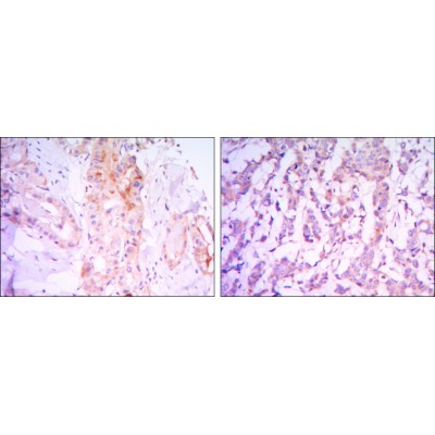 Валидация Affinity BF0063 - 5121