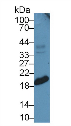 14754
