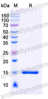 Валидация SDS-PAGE - AntibodySystem RHC19804