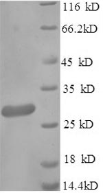 SDS-PAGE