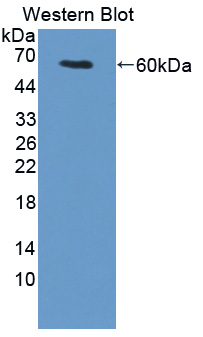 57177