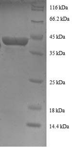 SDS-PAGE