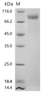 SDS-PAGE