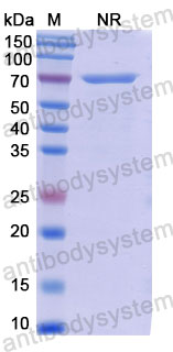 Валидация SDS-PAGE - AntibodySystem DHE07716