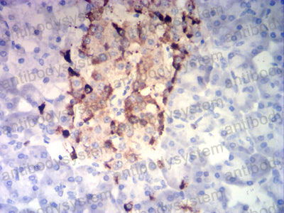 Валидация AntibodySystem RHC82704
