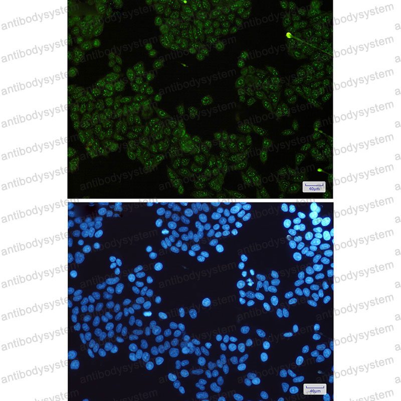 Валидация IF - AntibodySystem RHN62001