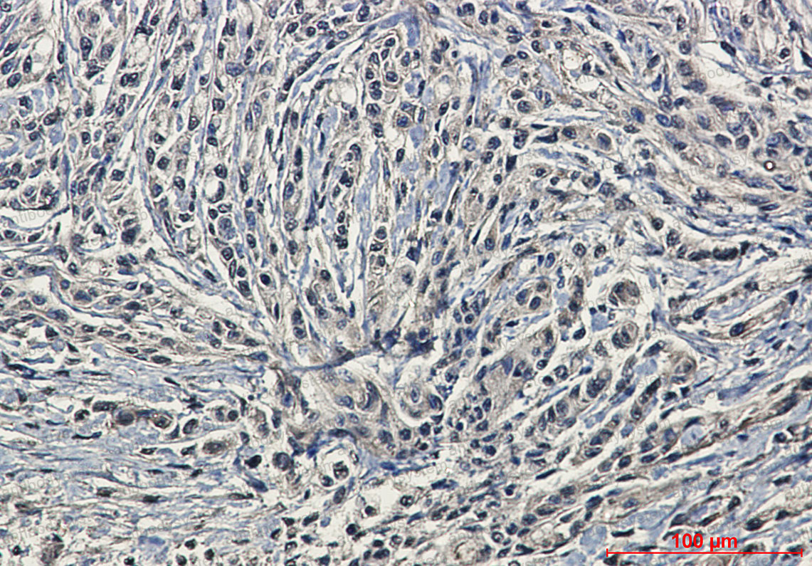 Валидация AntibodySystem RHD23202