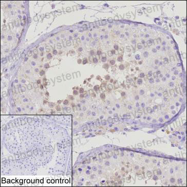 Валидация AntibodySystem RHE31601