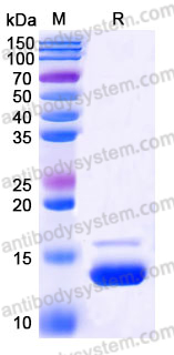 YHE55404, SDS-PAGE