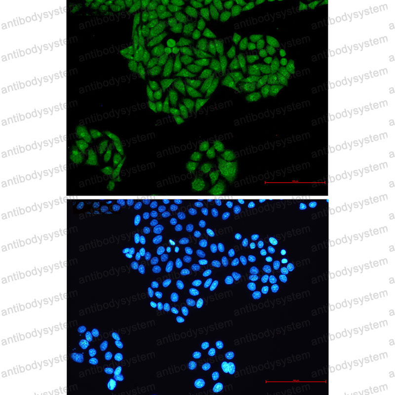 Валидация IF - AntibodySystem RHE05603