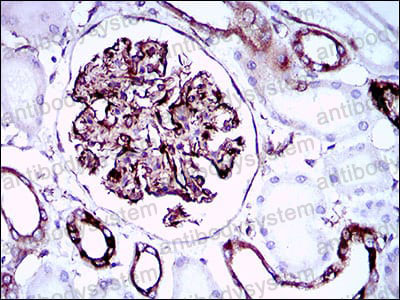 Валидация AntibodySystem RHN28602