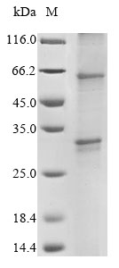 SDS-PAGE