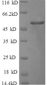 SDS-PAGE