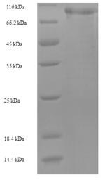 SDS-PAGE