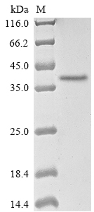 SDS-PAGE