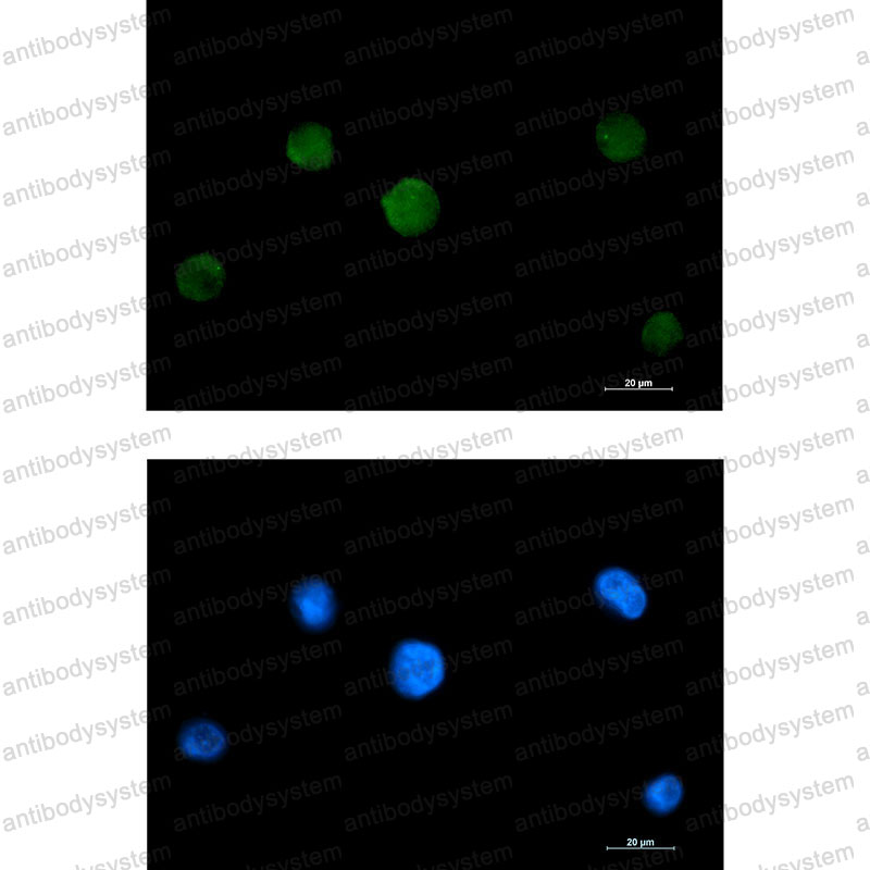 Валидация IF - AntibodySystem RHN80601