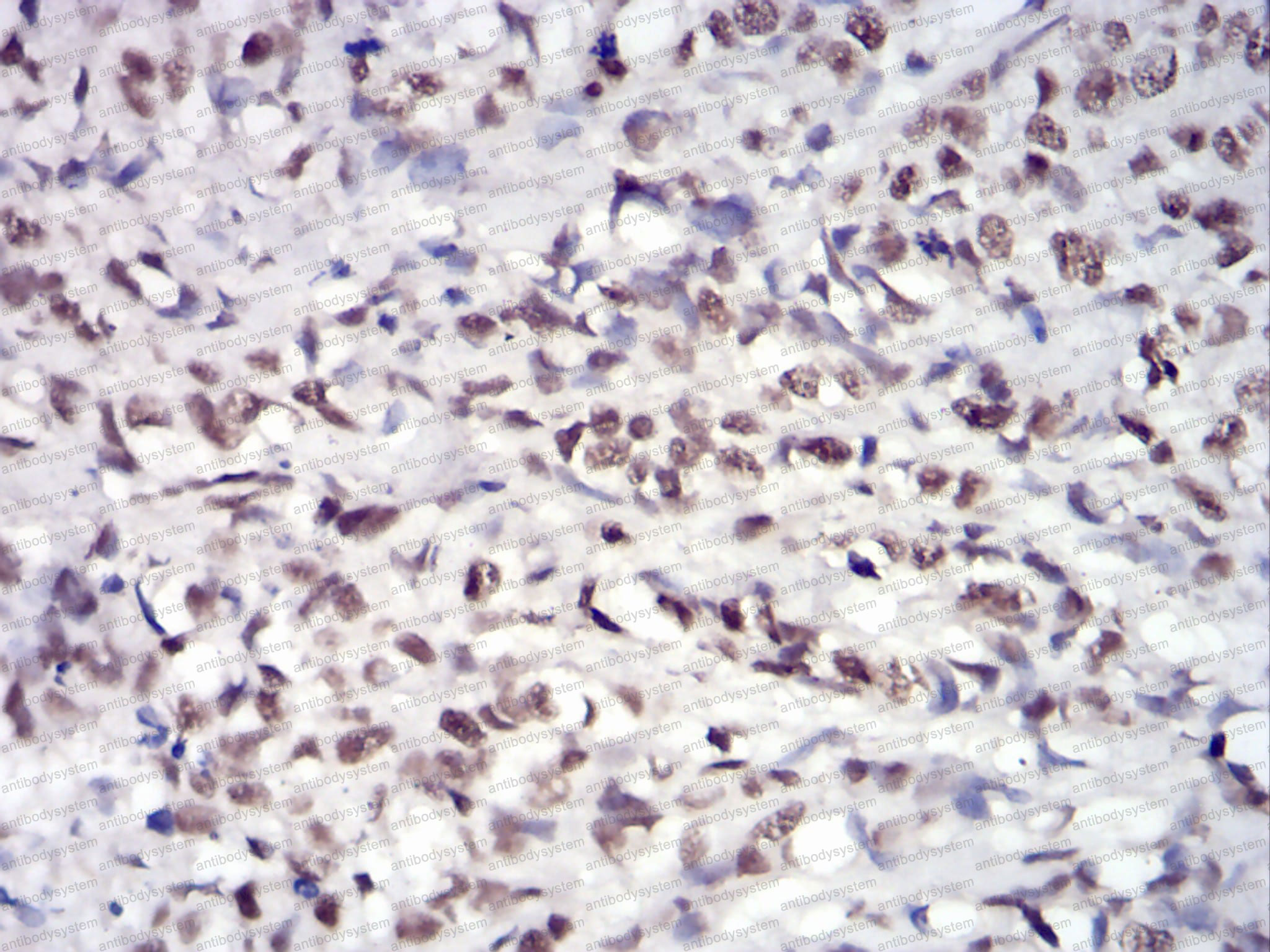 Валидация AntibodySystem RHA97302