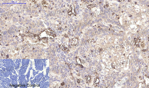 Валидация AntibodySystem RHC34010