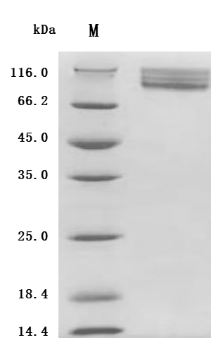 SDS-PAGE