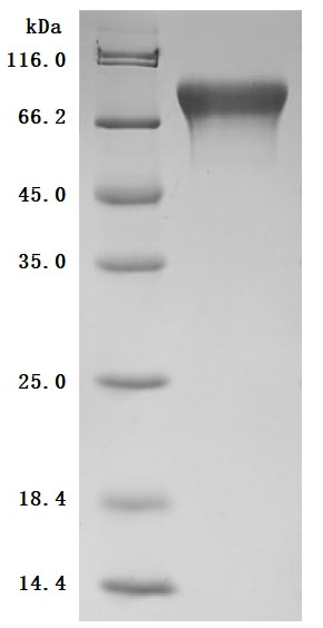 SDS-PAGE
