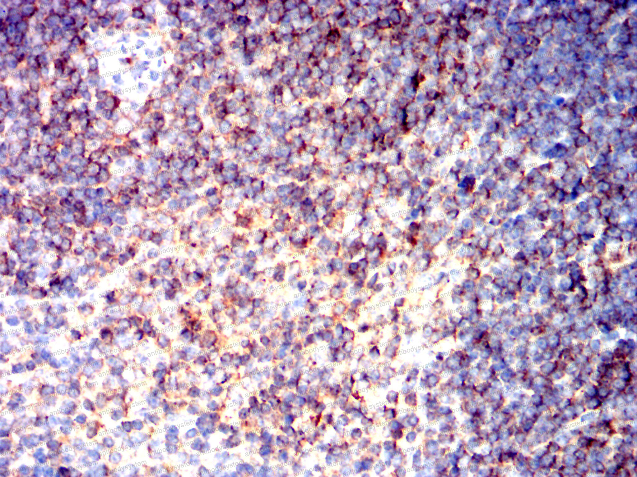 Валидация AntibodySystem RHE03401 (1919)