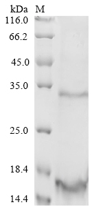 SDS-PAGE