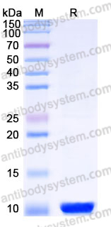 YHJ28901, SDS-PAGE