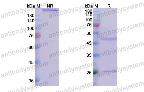Валидация SDS-PAGE - AntibodySystem DHC19101